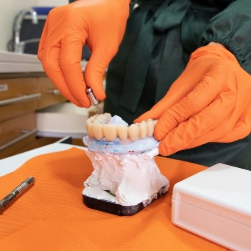 beneficios implantes dentales zaragoza