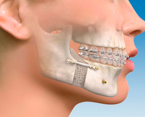 cirugia maxilofacial cabecera