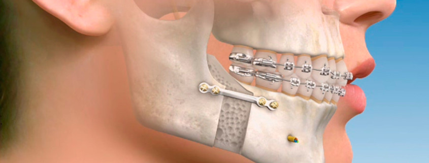 cirugia maxilofacial cabecera