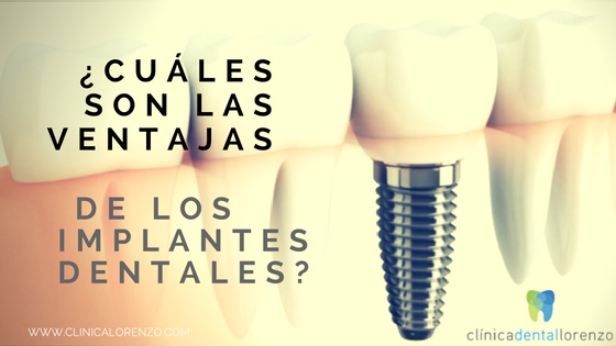 ¿Cuáles son las ventajas
