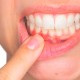Recuperar las encías perdidas Clínica Dental Lorenzo