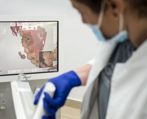 Odontologia Digital Escaner Intraoral Clinica Lorenzo Zaragoza