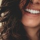 beneficios carillas dentales