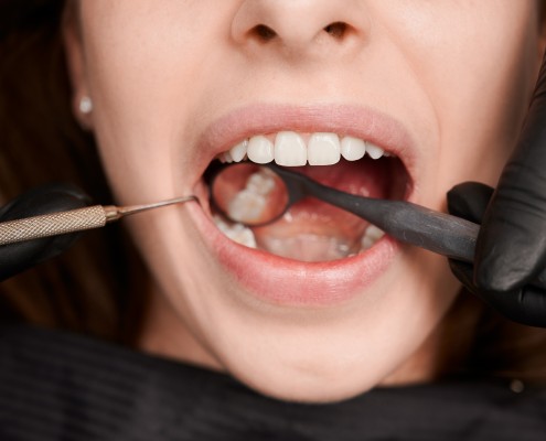 Periodonica en Zaragoza: Cuidado Periodontal